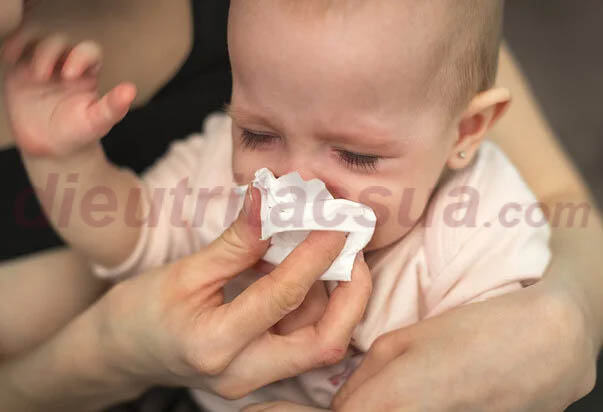 Khi bé bị sổ mũi, nghẹt mũi thường có dấu hiệu gì?